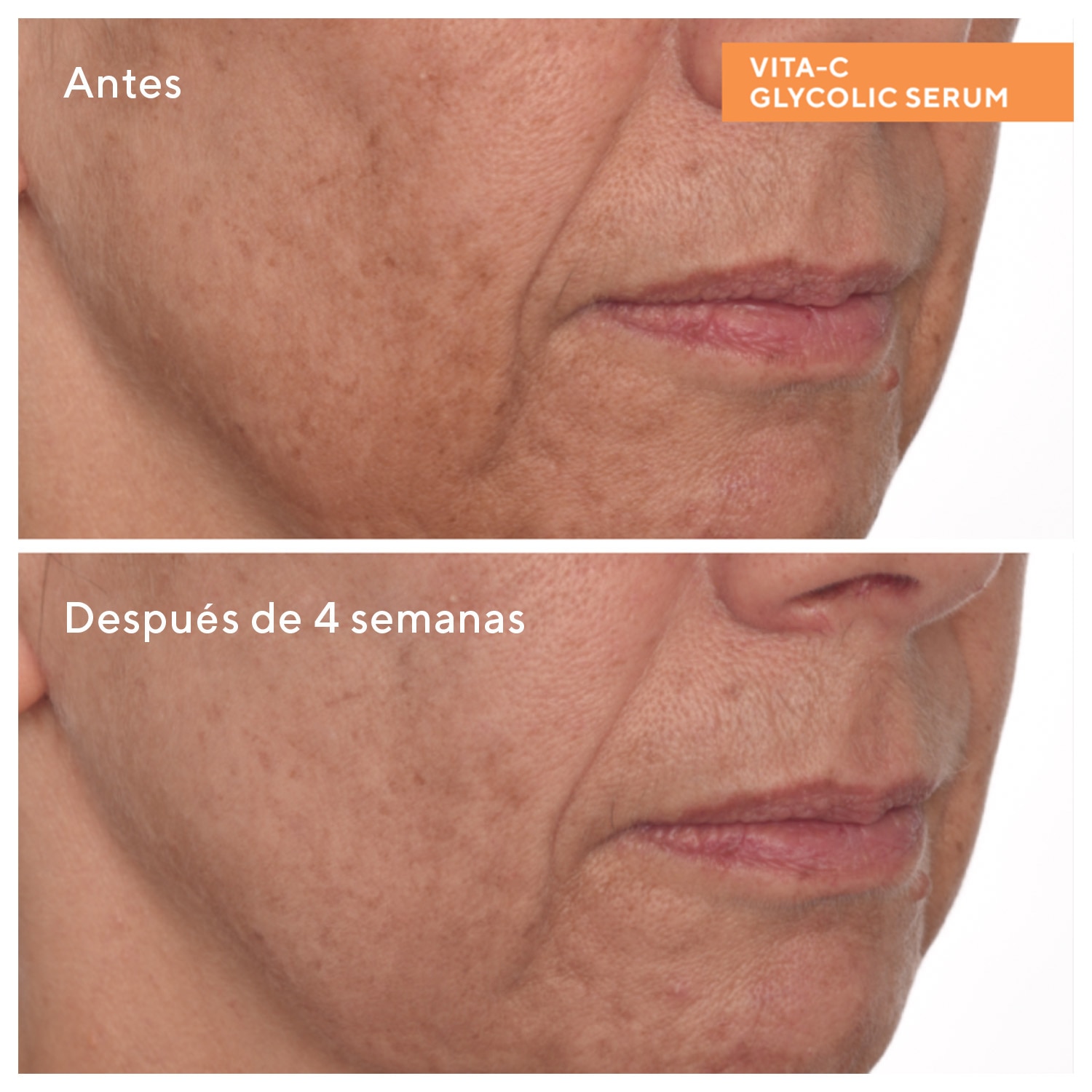 VITA-C GLYCOLIC SERUM (SUERO CON VITAMINA C)